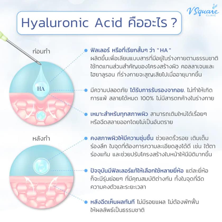 Hyaluronic Acid