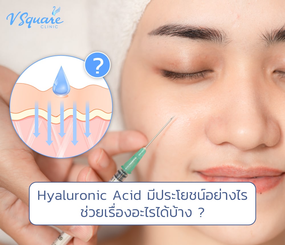 Hyaluronic Acid