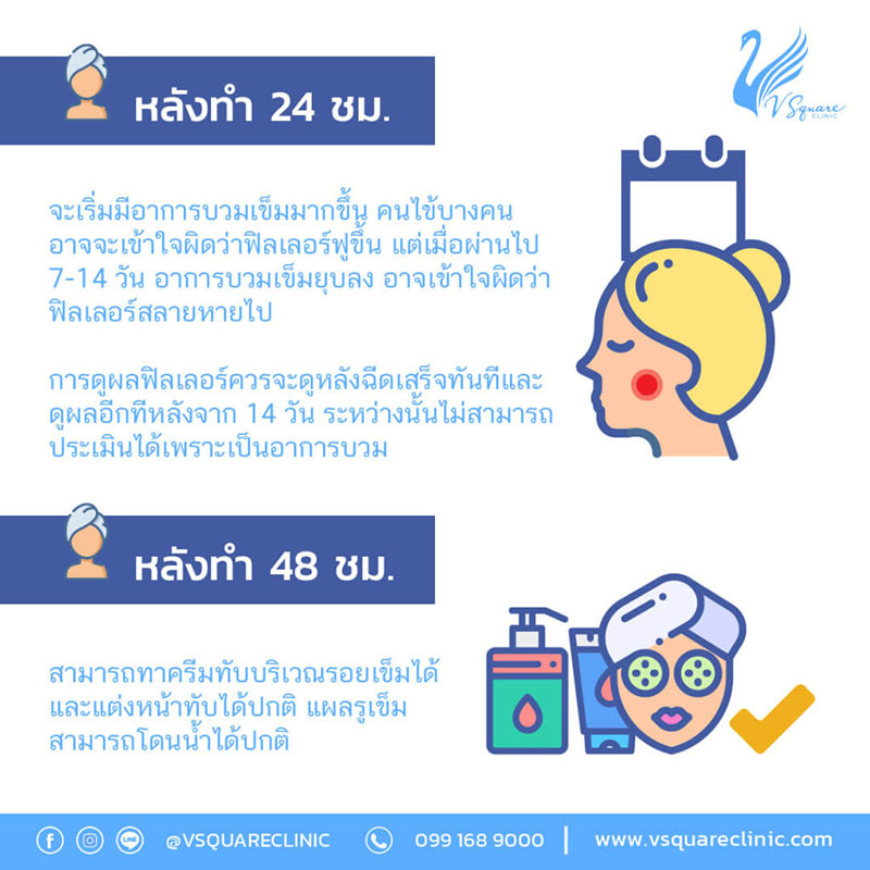 อาการหลังฉีดฟิลเลอร์คาง 24 ชม.