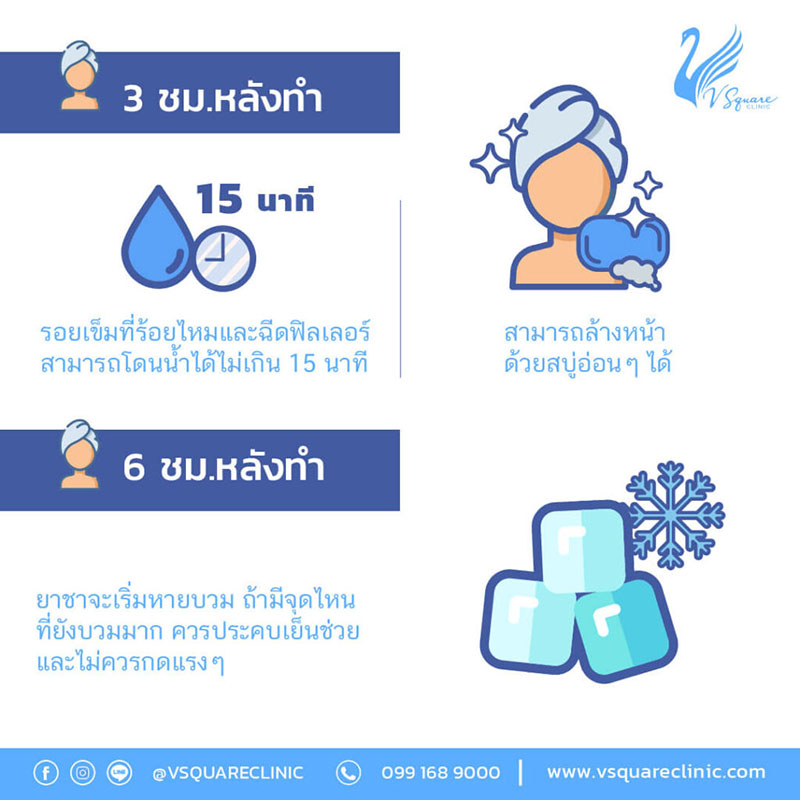 อาการหลังฉีดฟิลเลอร์คาง 3-6 ชม.