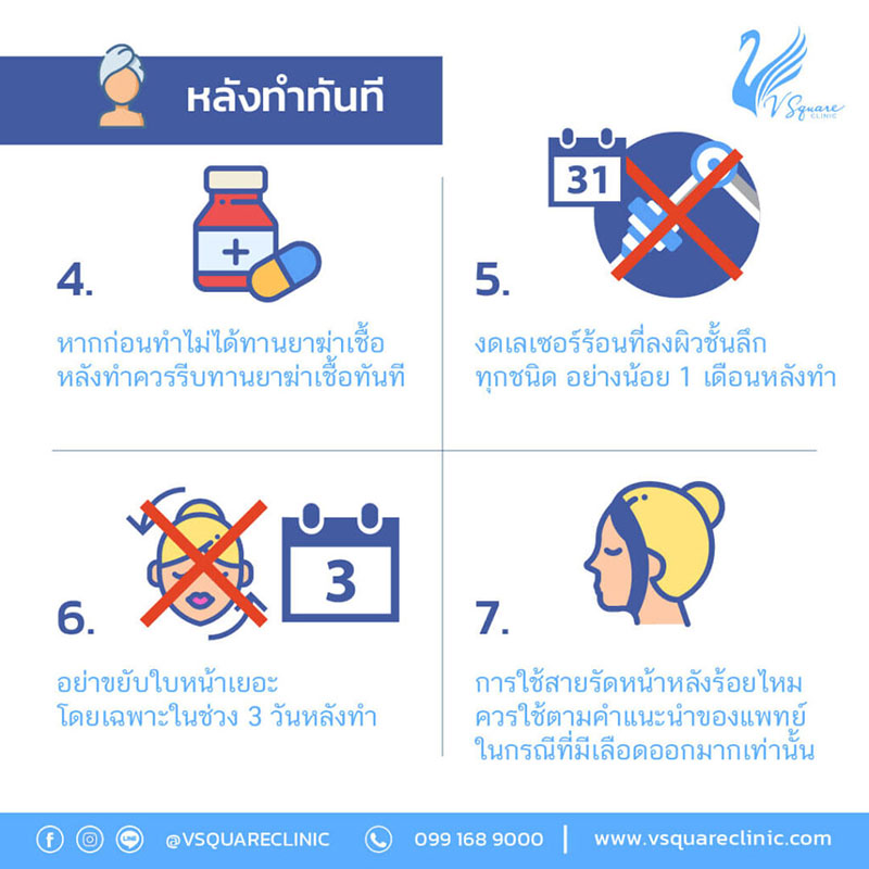 อาการหลังฉีดฟิลเลอร์คางทันที