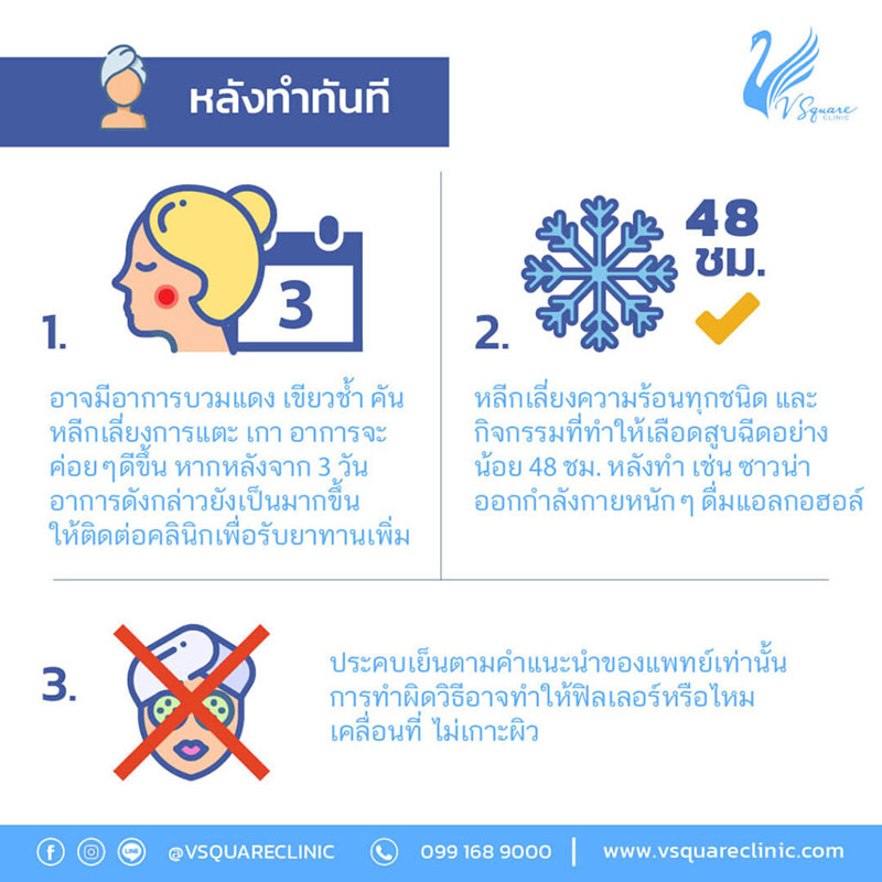 อาการหลังฉีดฟิลเลอร์คางทันที