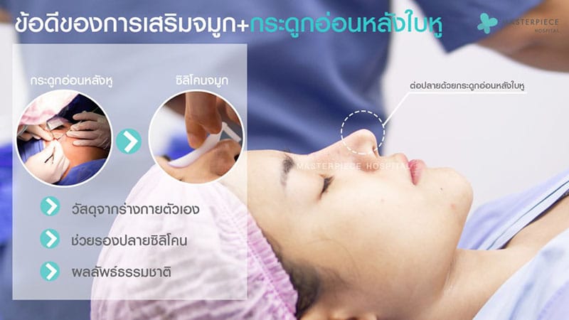 เสริมจมูกกระดูกอ่อน