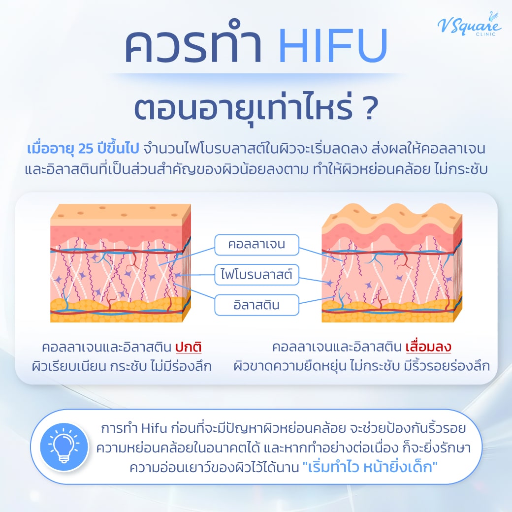 ควรทำ hifu ตอนอายุเท่าไร