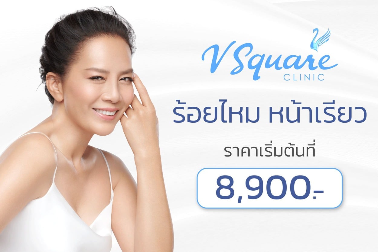 ร้อยไหม ราคา
