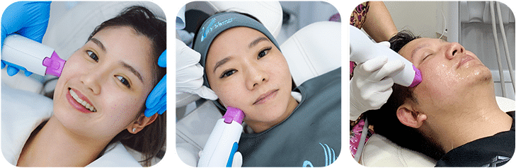 Thermage เหมาะกับใคร