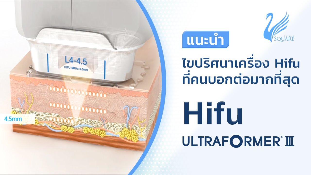 Hifu คืออะไร ? ทำไม ? Hifu Ultraformer
