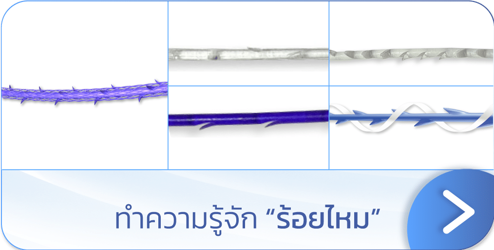 ร้อยไหม คืออะไร