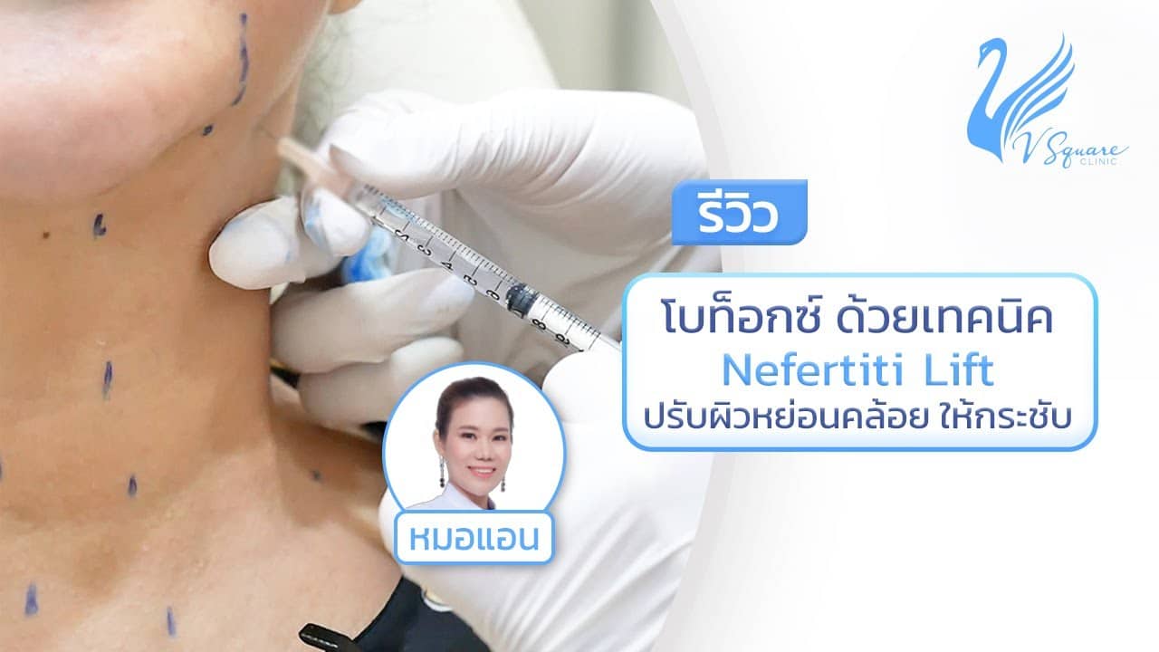 ฉีดโบท็อกลิฟหน้าเรียว กี่วันเห็นผล อยู่ได้นานแค่ไหน
