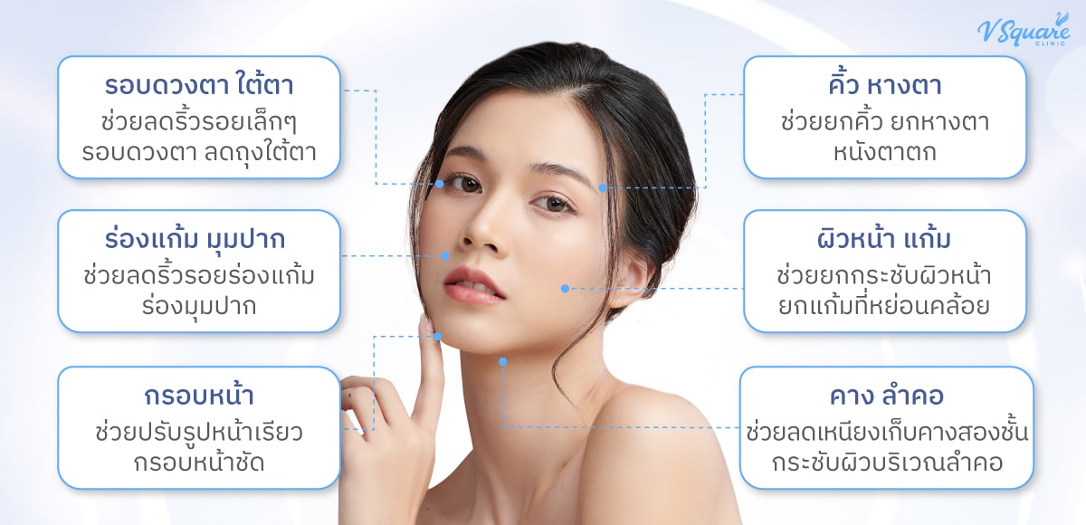 Hifu-ทำตำแหน่งไหนได้บ้าง (1)