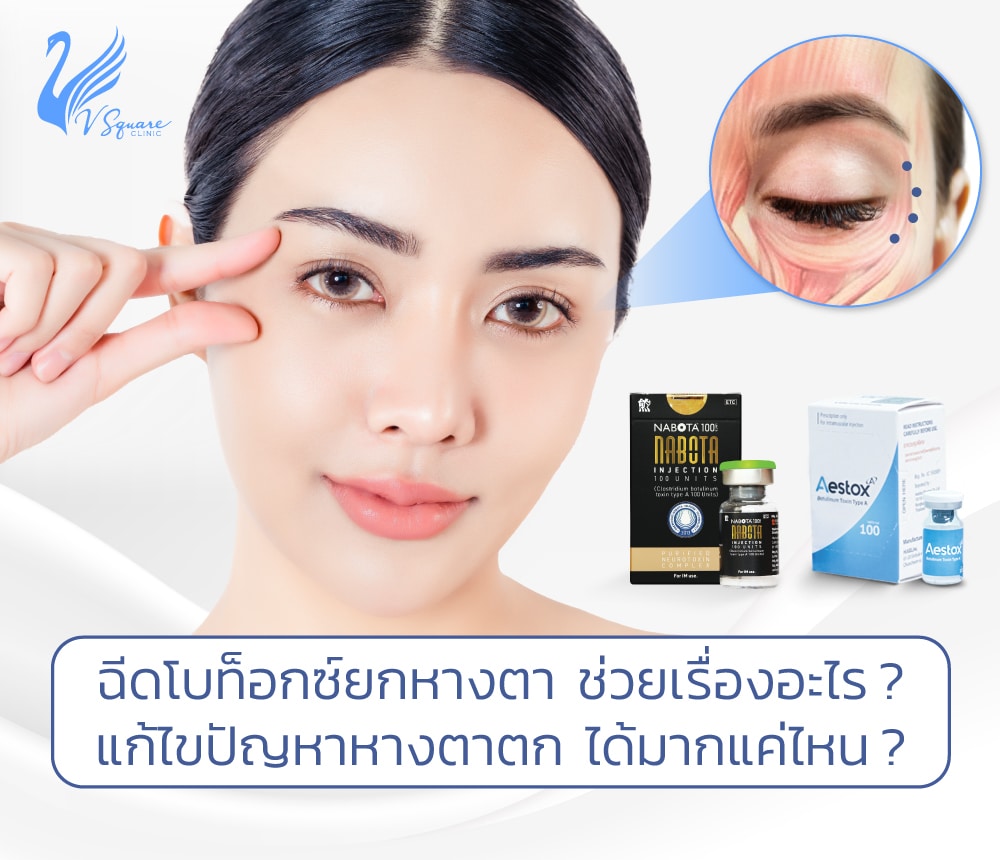 ฉีดโบท็อกยกหางตา
