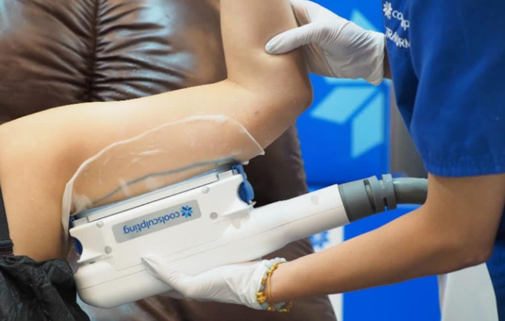 หัว CoolSculpting