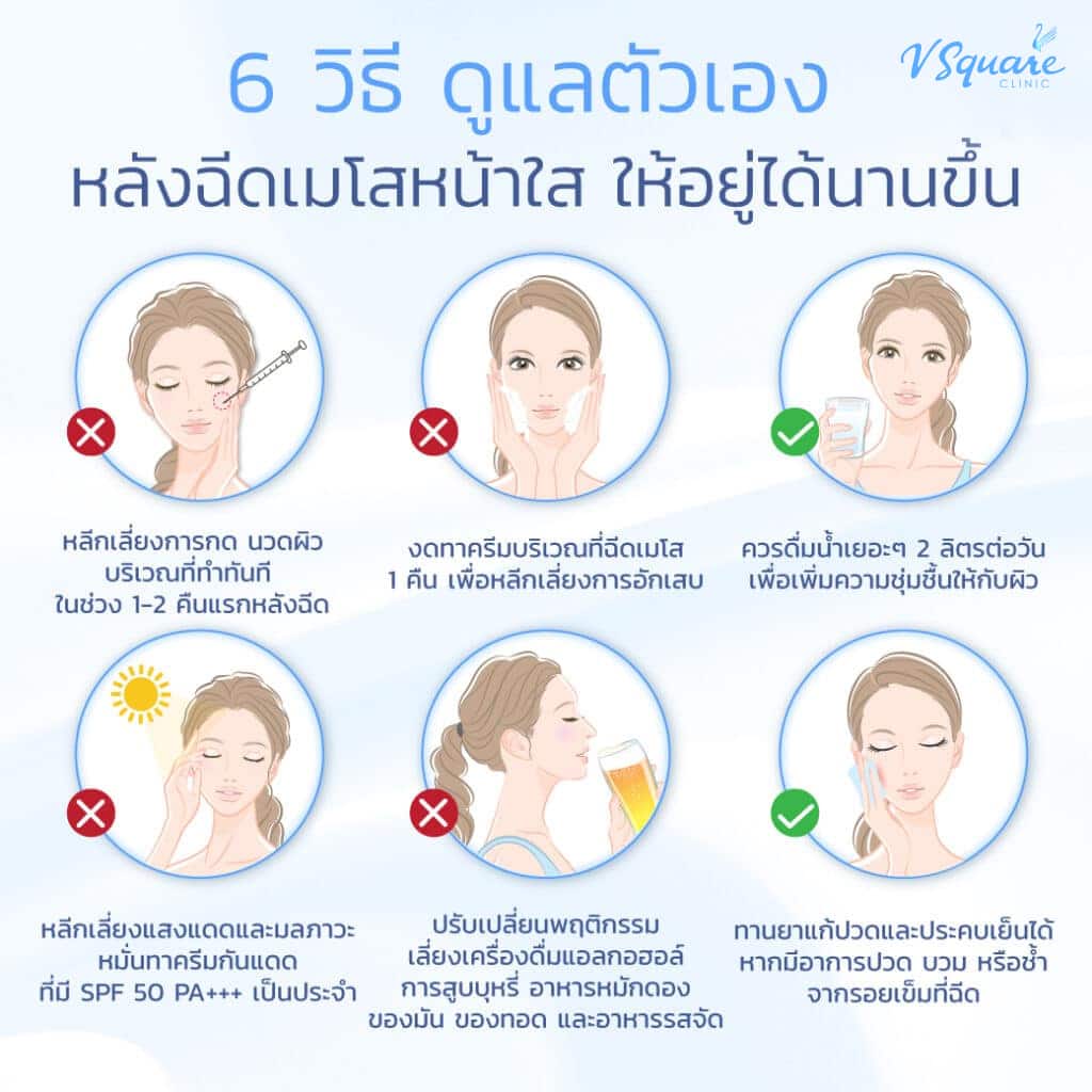ดูแลหลังฉีดเมโสหน้าใส