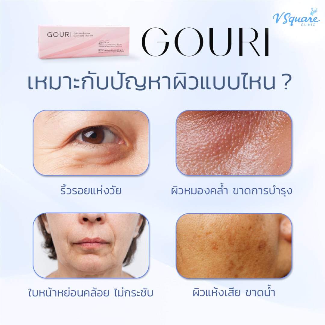 การฉีด Gouri เหมาะกับใคร