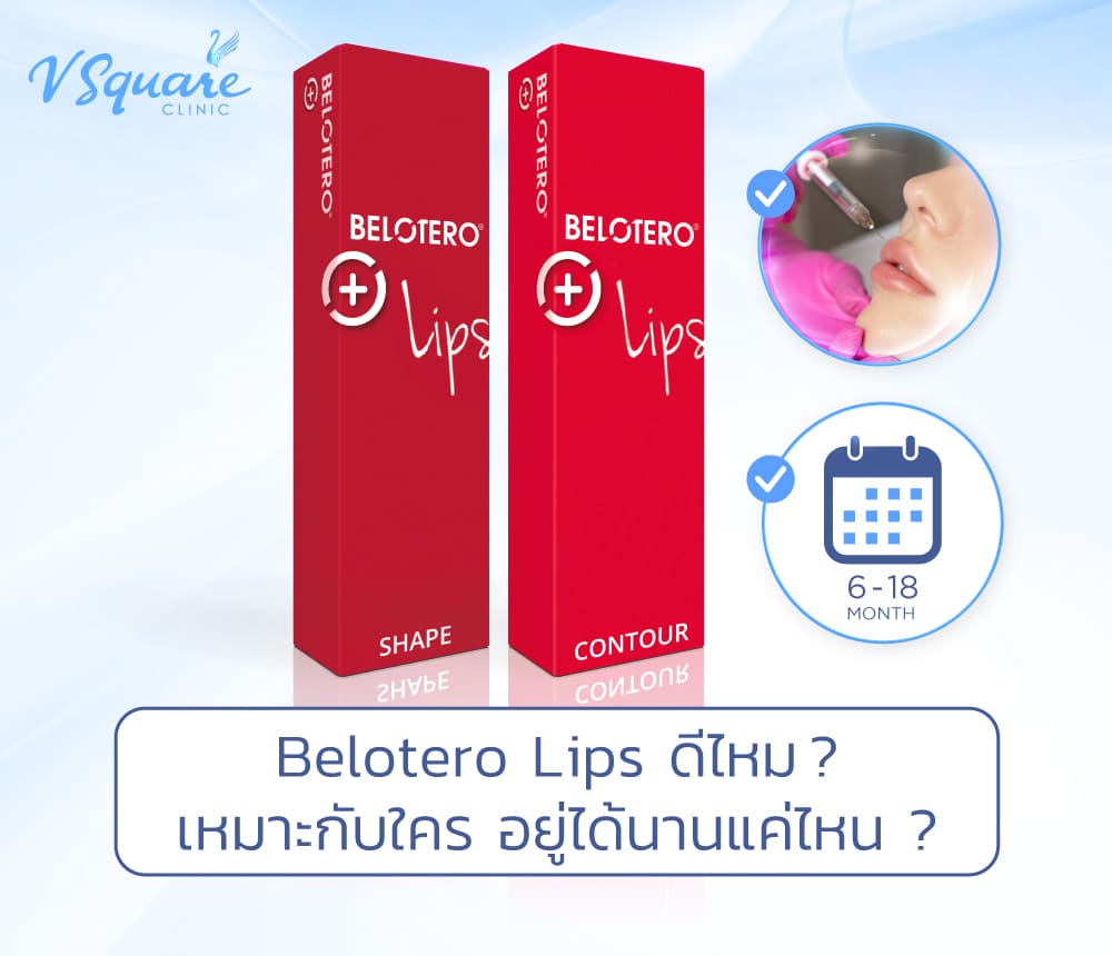 Belotero Lips