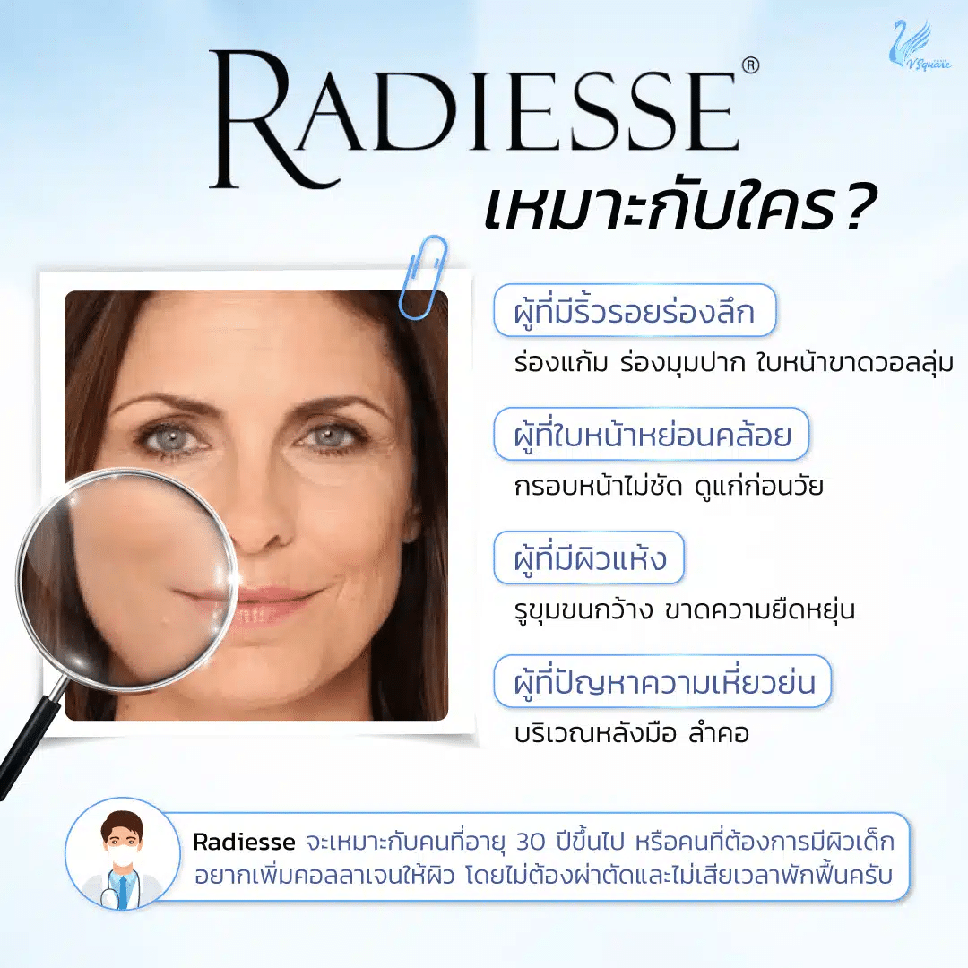 Radiesse เหมาะกับใคร