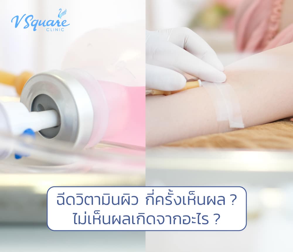 ฉีดวิตามินผิว กี่ครั้งเห็นผล