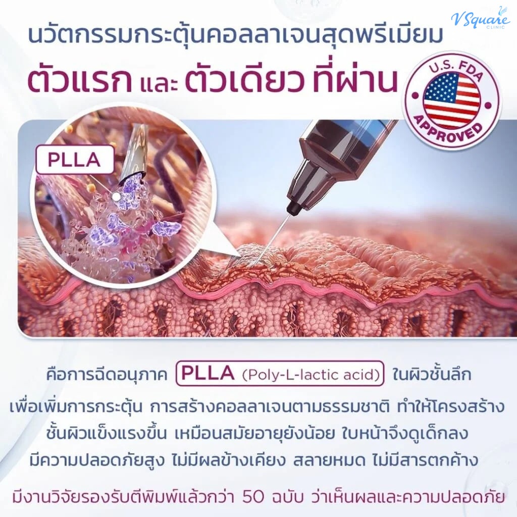 Sculptra คืออะไร