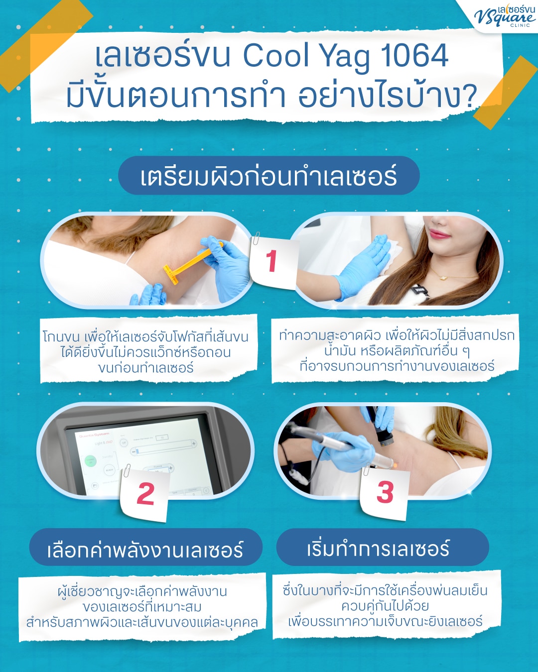 ขั้นตอนการทำเลเซอร์ขนรักแร้