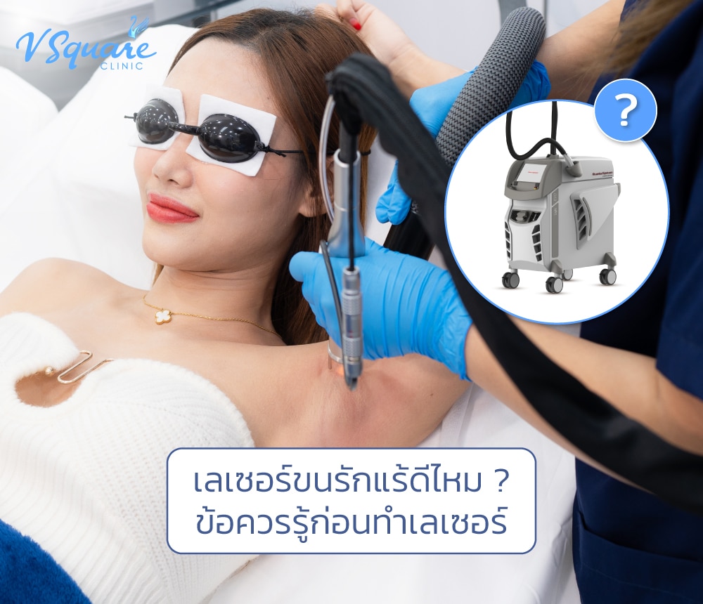 เลเซอร์ขนรักแร้