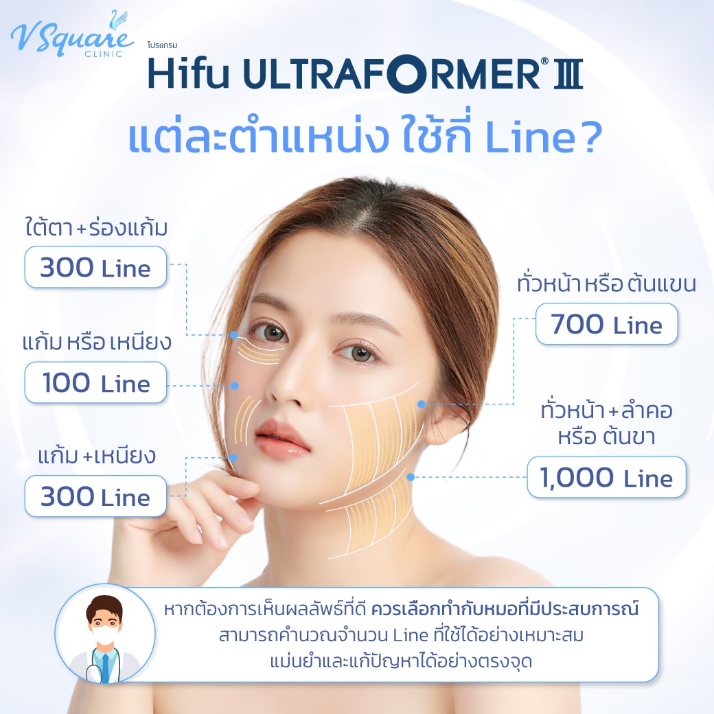 Hifu Ultraformer III แต่ละตำแหน่งใช้กี่ไลน์ _