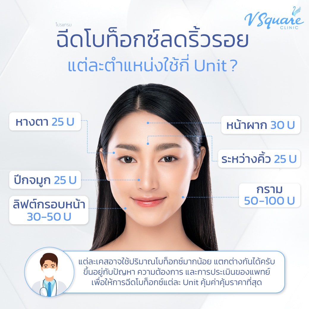 Nabota Botox ใช้กี่ U