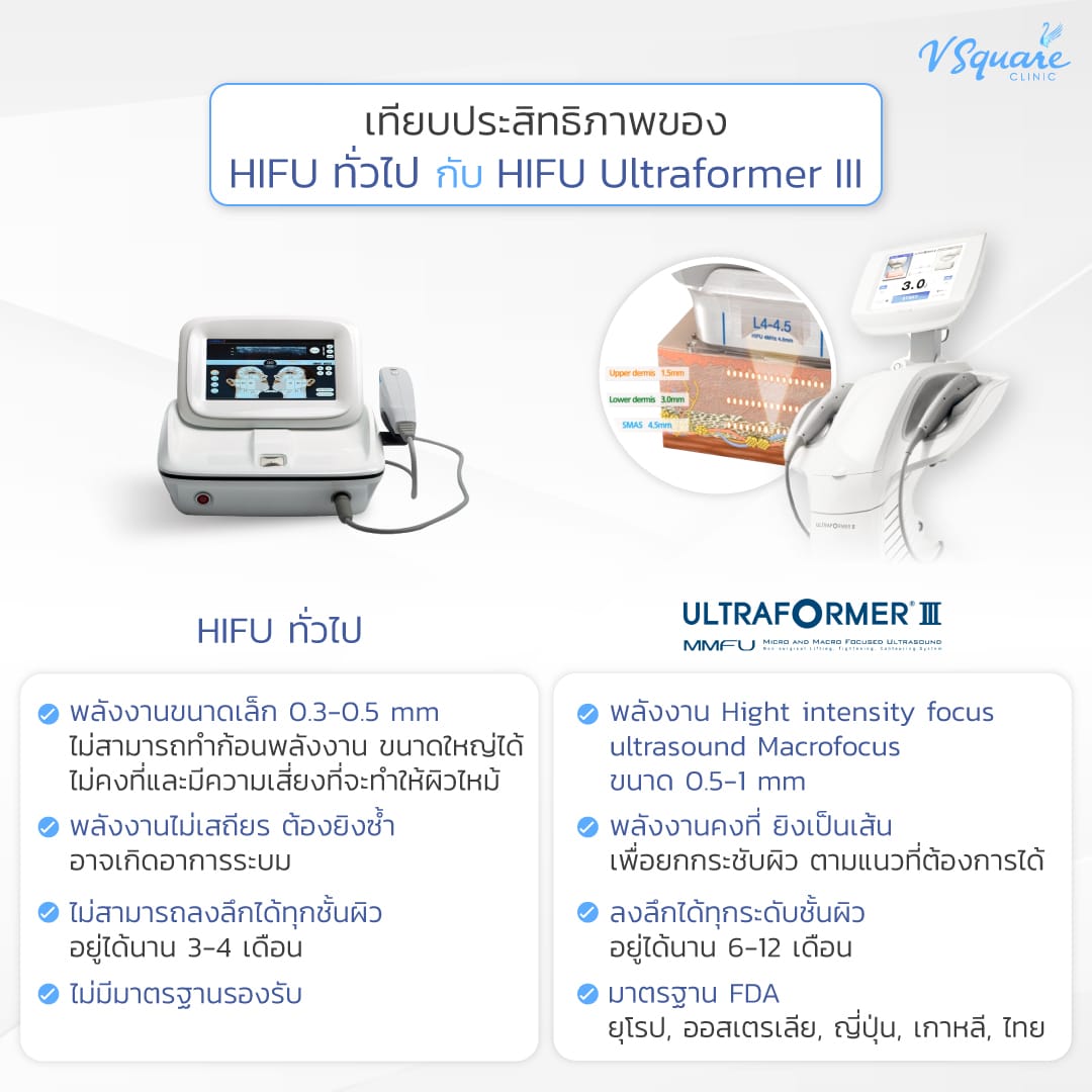 Ultraformer III ต่างจาก Hifu รุ่นอื่นอย่างไร _