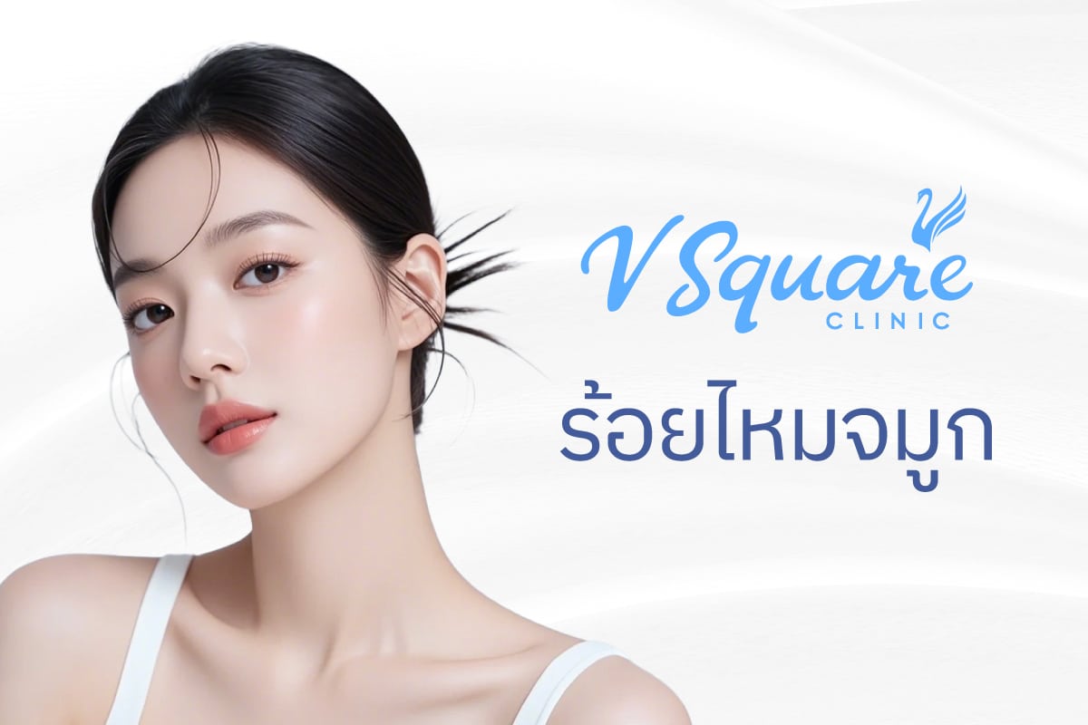 ร้อยไหมจมูก ราคาเริ่มต้น
