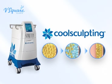 ทำ-Coolsculpting-ที่ไหนดี-มีวิธีเลือกคลินิกอย่างไร-370x277