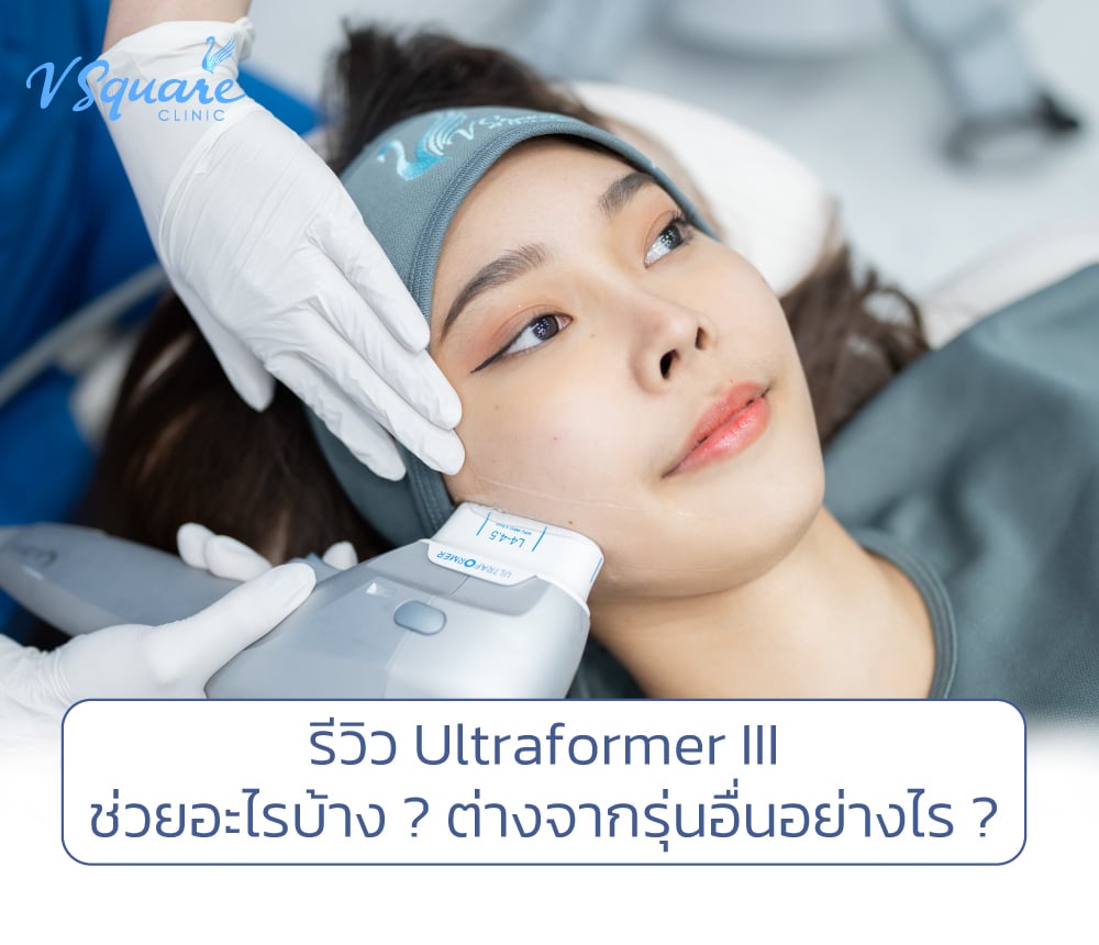 รีวิว Ultraformer III(1)