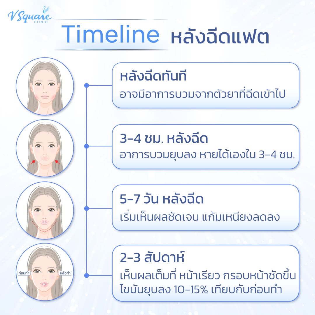 หลังฉีดเมโสแฟต แล้วหน้าบวมปกติไหม