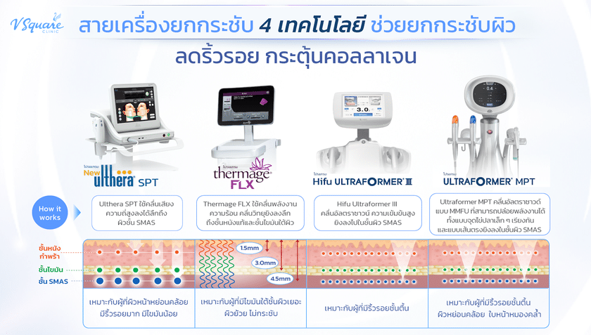 เปรียบเทียบเครื่องยกกระชับ