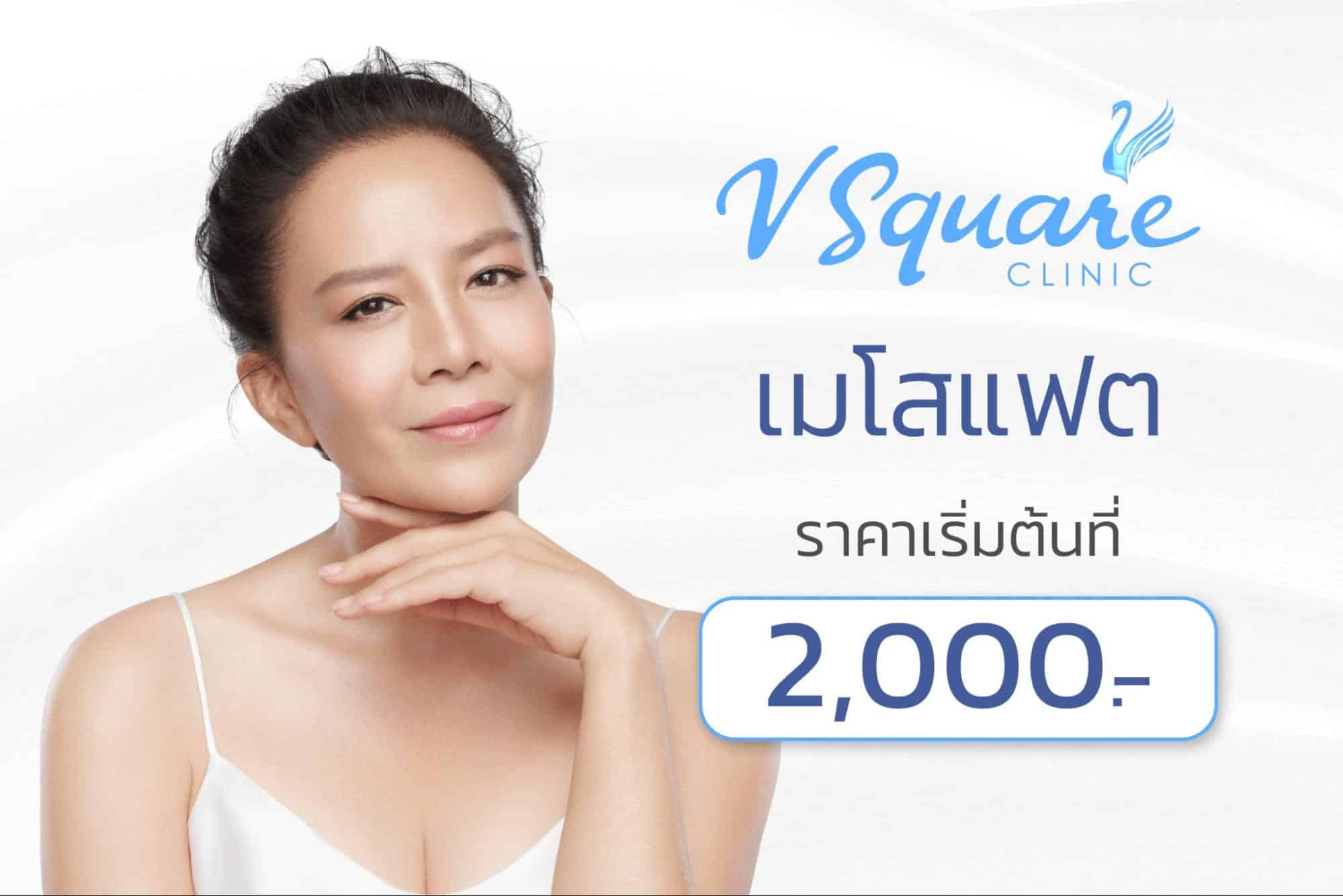 เมโสแฟตราคา คุณต่าย