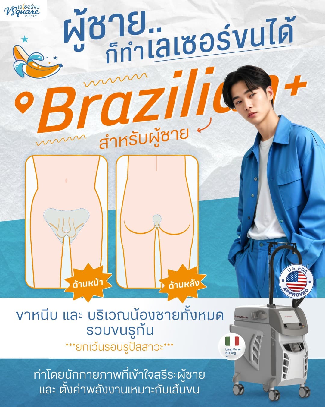 เลเซอร์ขนน้องชาย