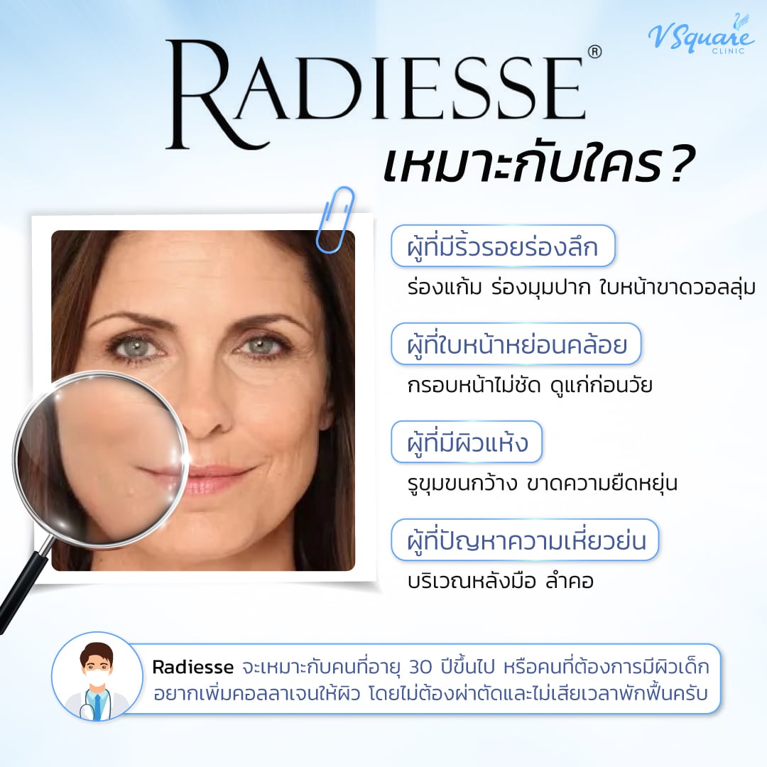 radiesse เหมาะกับใคร