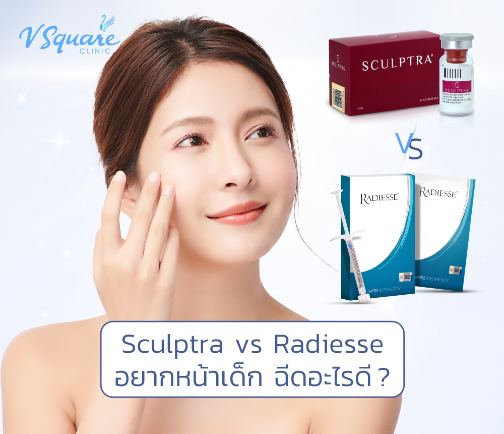 sculptra vs radiesse