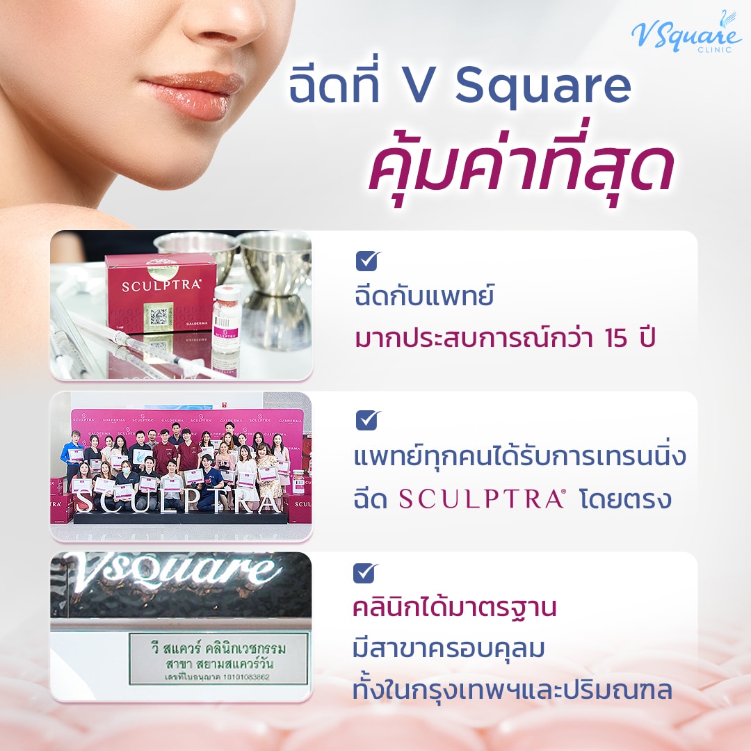 Sculptra Body ที่ V Square Clinic