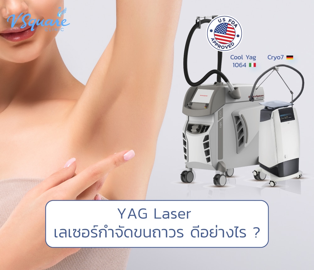 YAG Laser