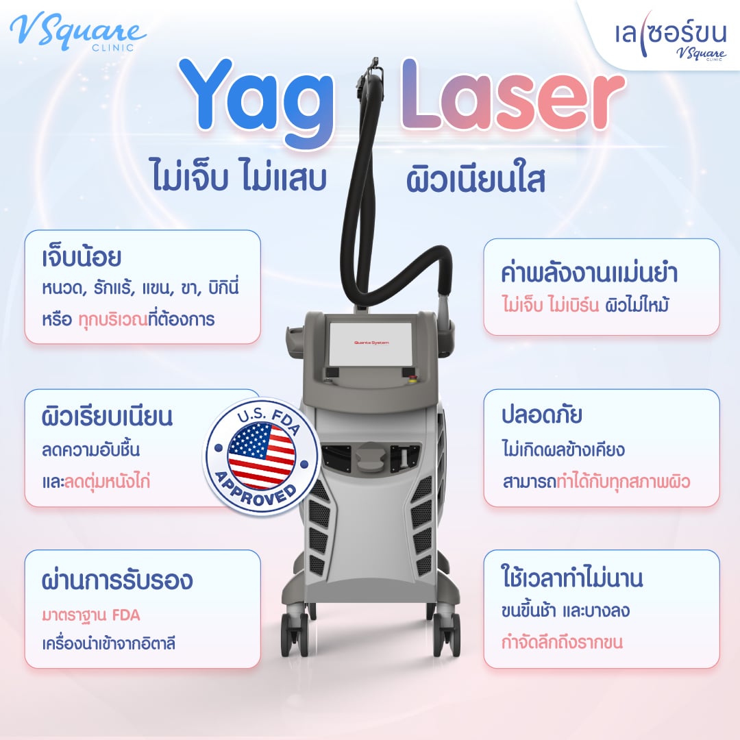 ข้อดีของการใช้ YAG Laser กำจัดขน