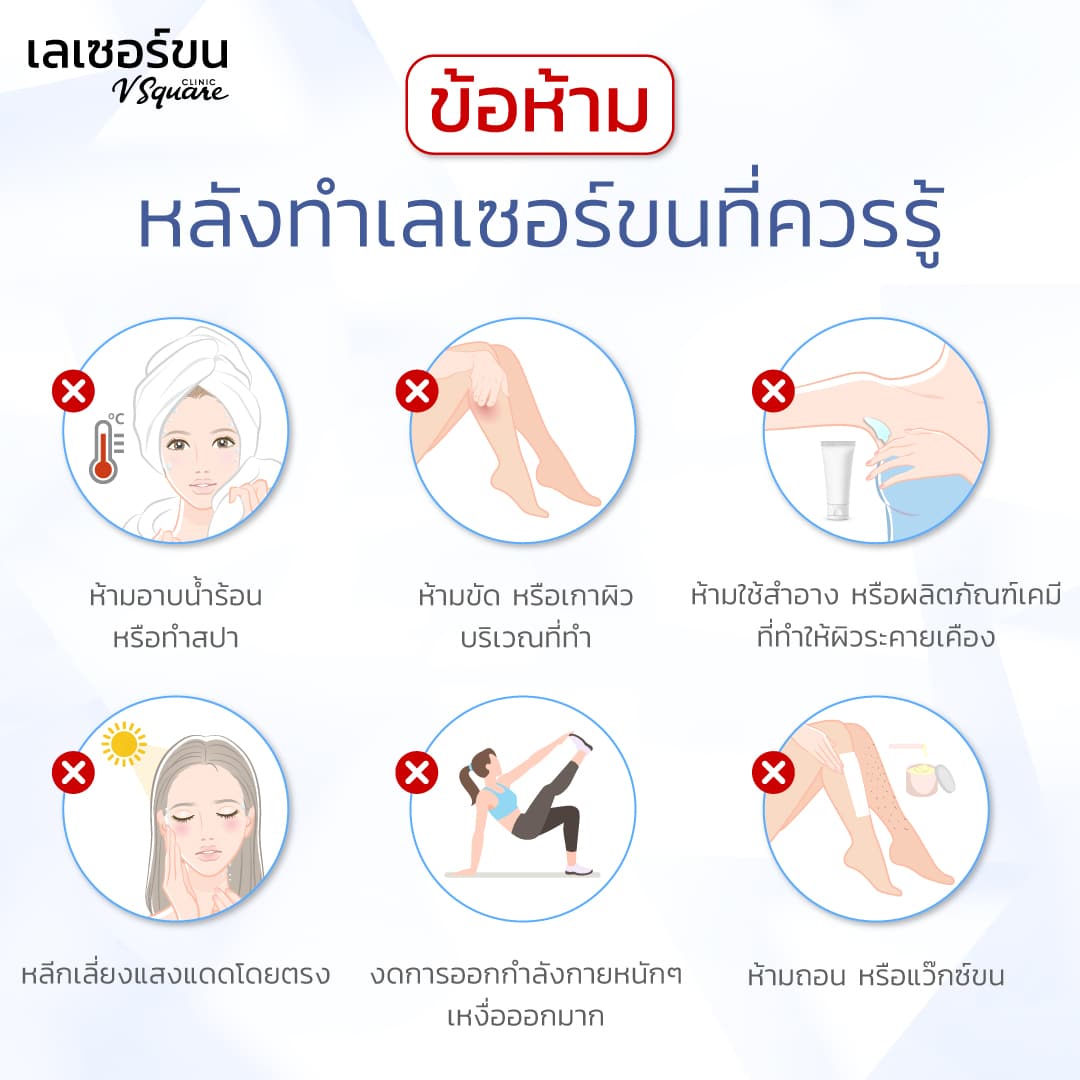 ข้อปฏิบัติหลังทำเลเซอร์