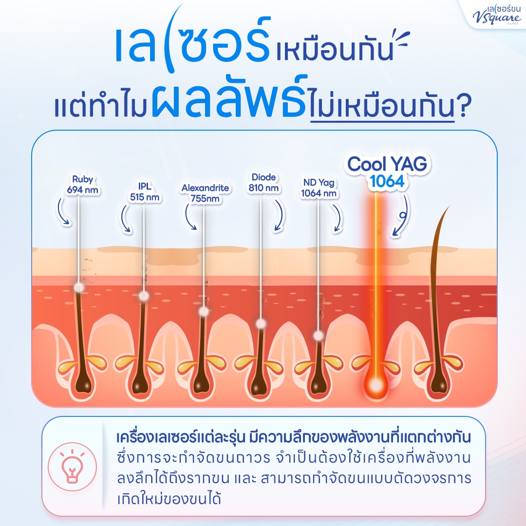 ความลึกของพลังงาน