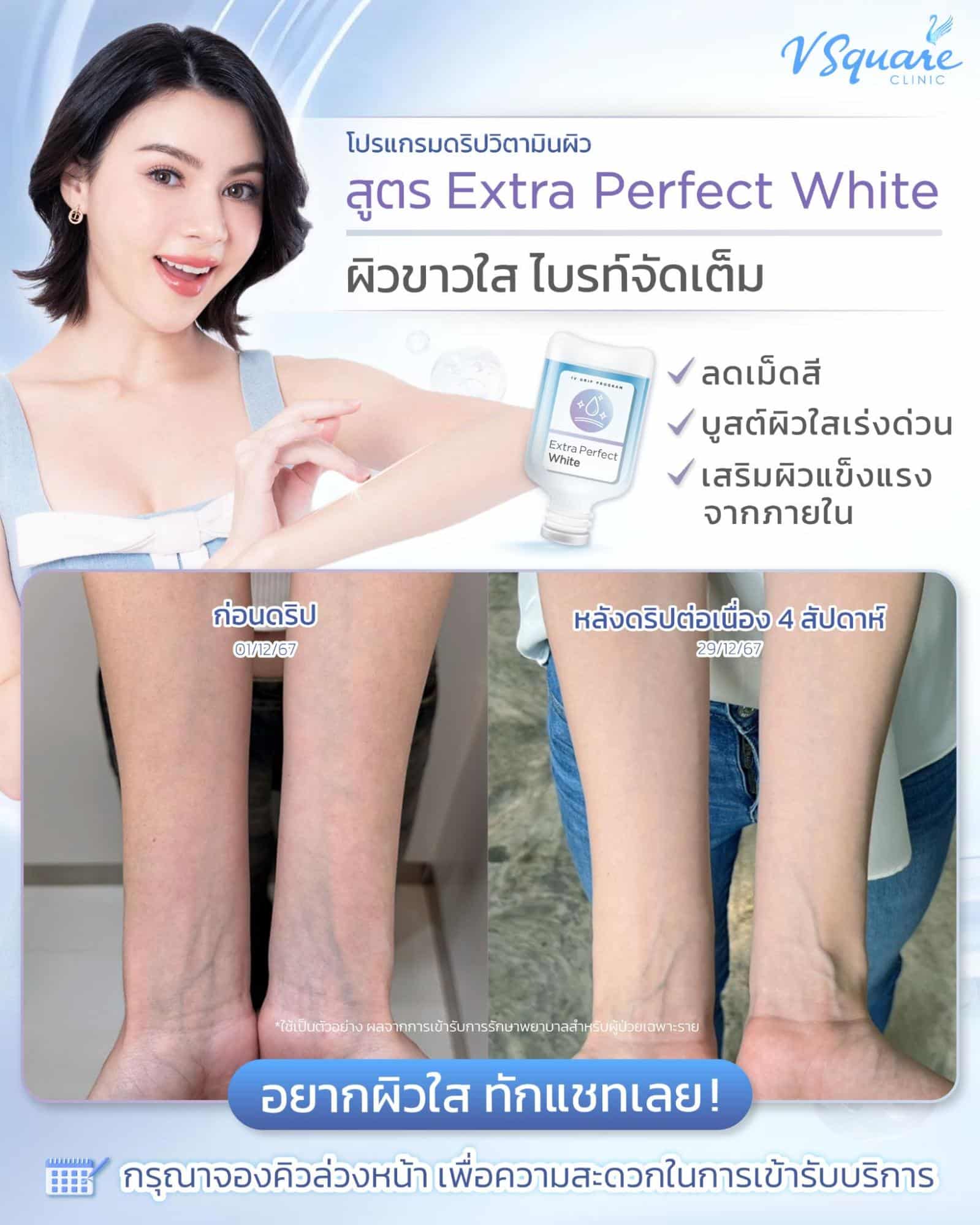 รีวิวผลลัพธ์ IV drip ผิว