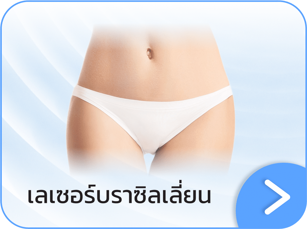 เลเซอร์ขนบราซิลเลี่ยน