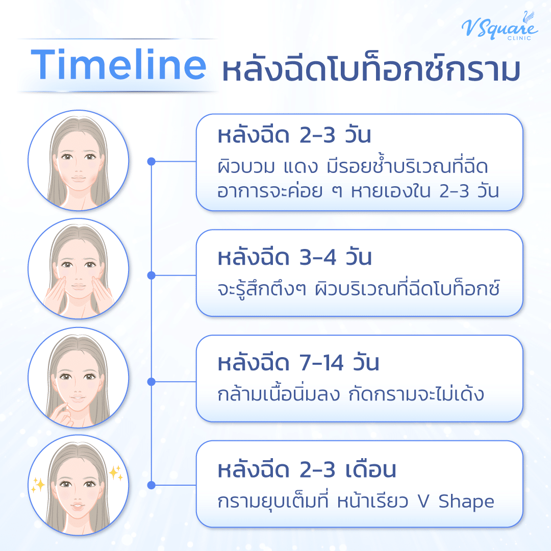 Timelime หลังฉีดโบกราม