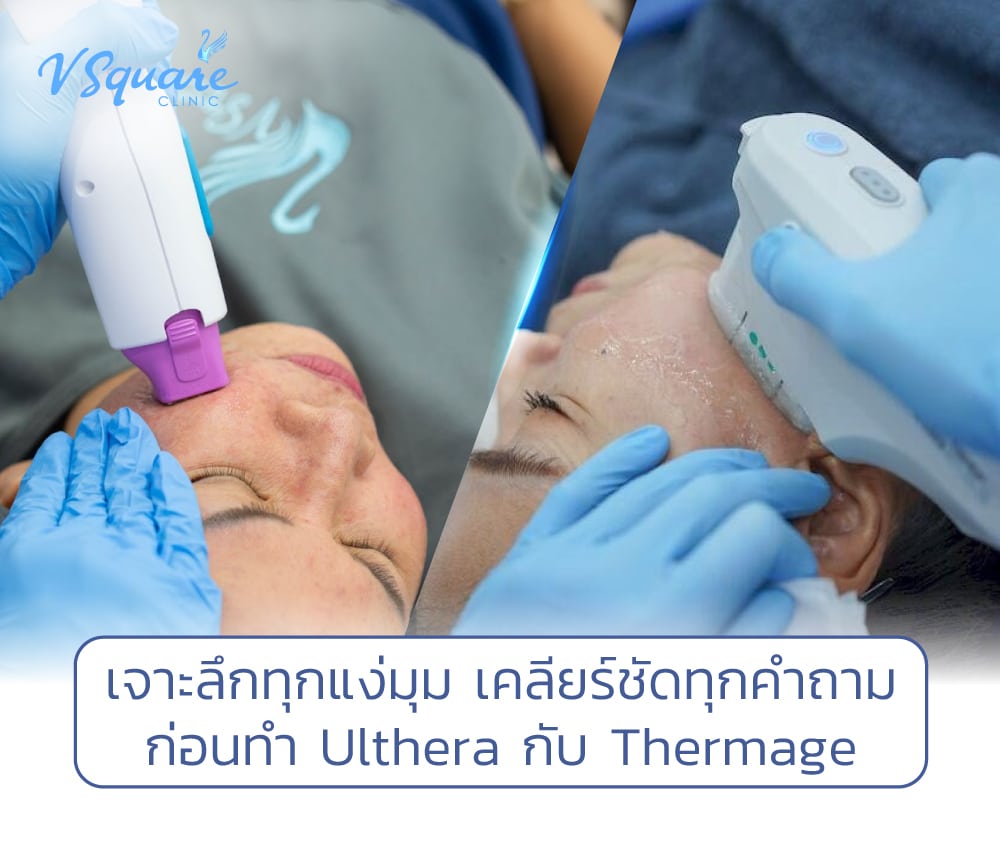 ulthera กับ thermage