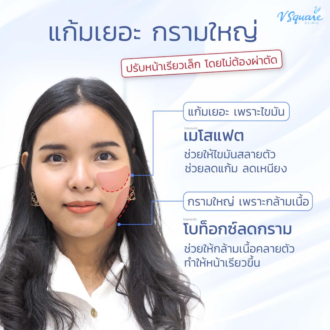 โบท็อกกับเมโสแฟต