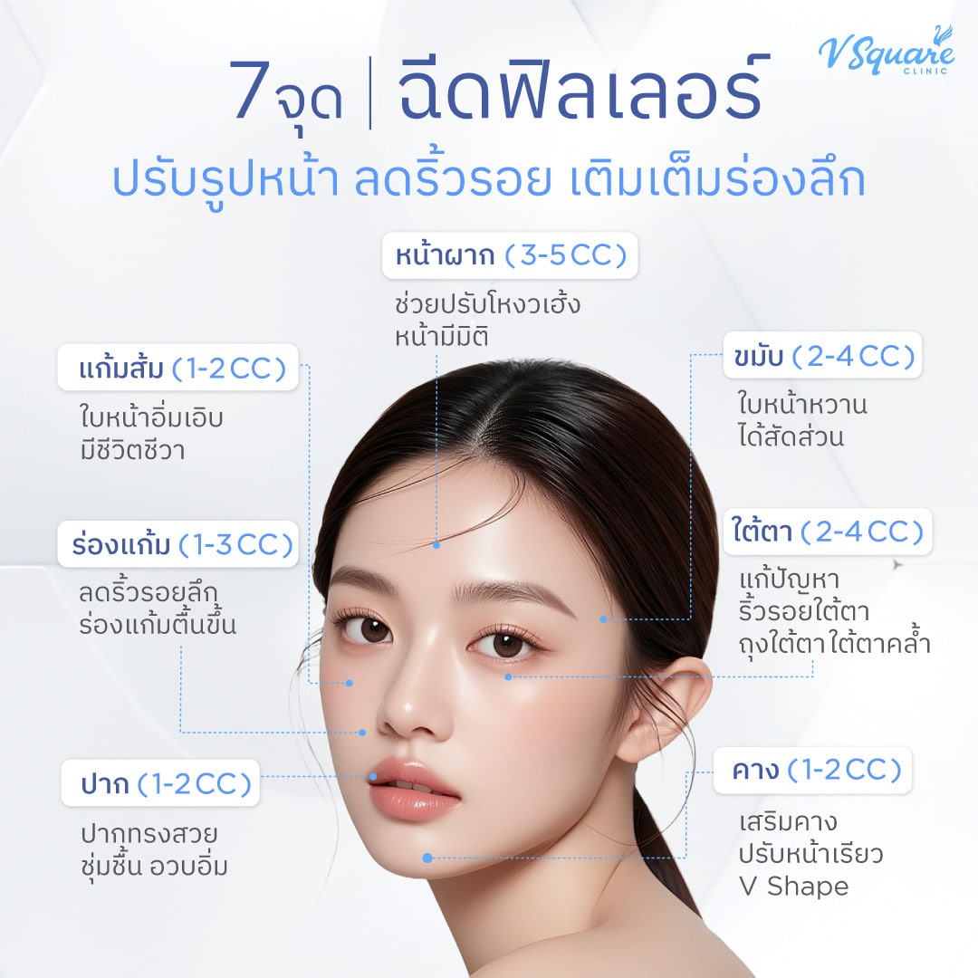 7-จุดฉีดฟิลเลอร์