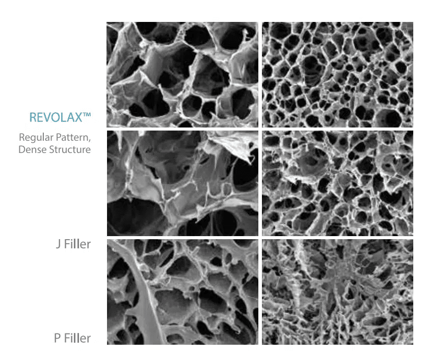 จุดเด่นของ Revolax Filler