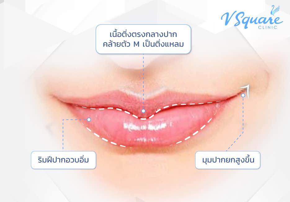 ปากมาสด้า(1)