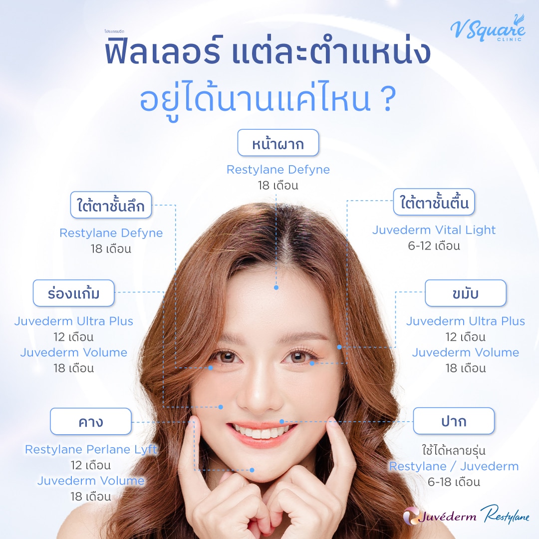 ฟิลเลอร์แต่ละตำแหน่งอยู่ได้นานแค่ไหน